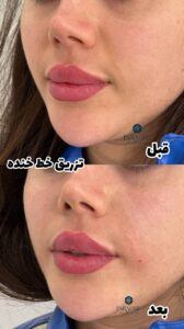 photo_2024-05-27_22-47-51