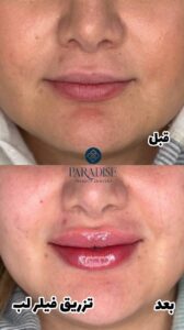 photo_2024-05-27_22-47-56